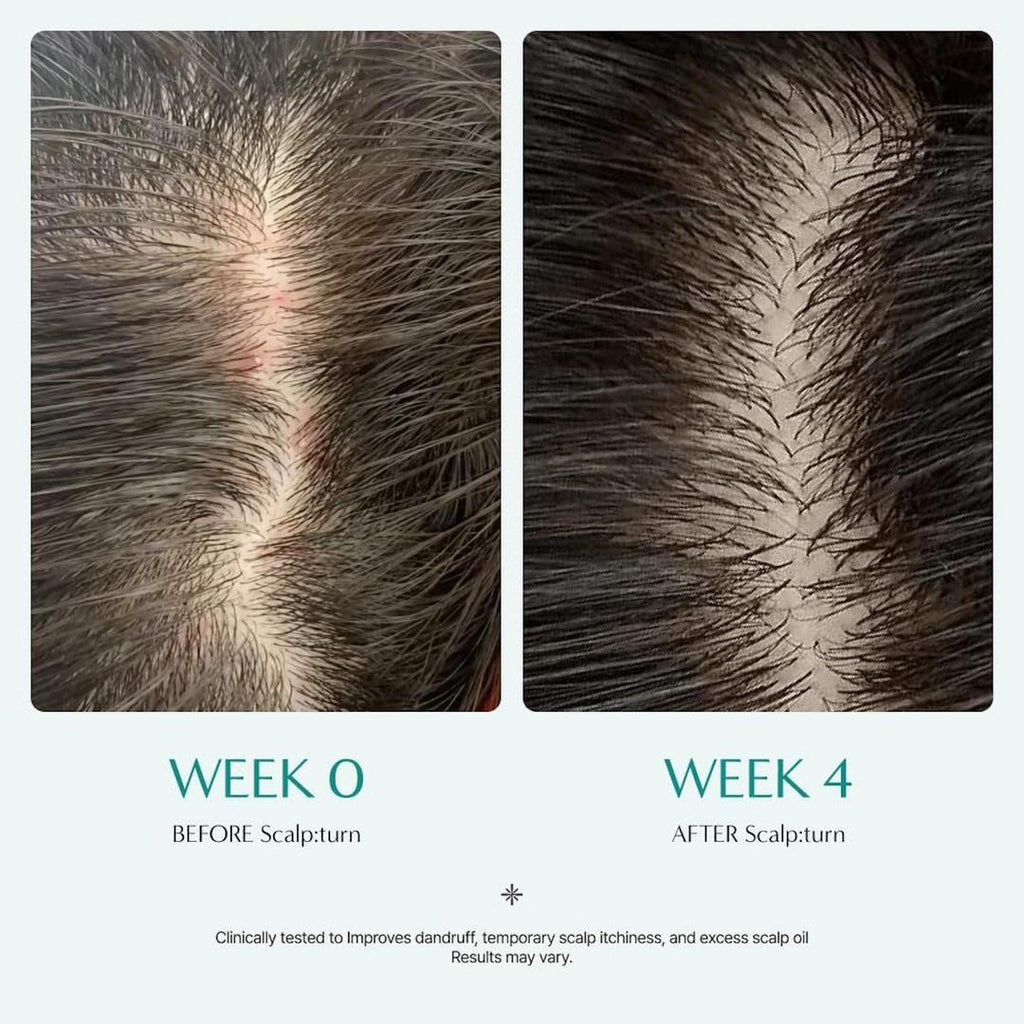 lilyeve Scalp Turn Cica PDRN Brush Ampoule 100mL