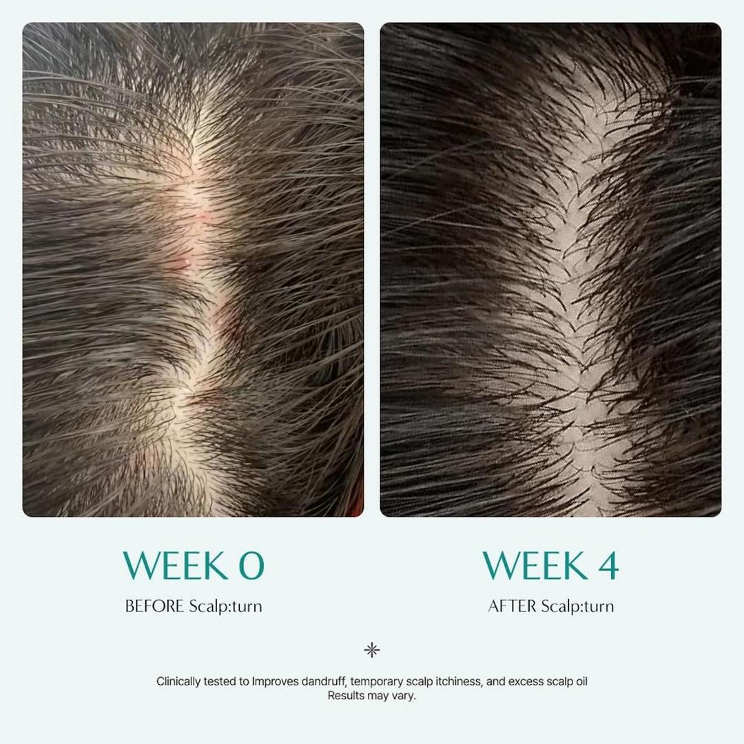 lilyeve Scalp Turn Cica PDRN Brush Ampoule 100mL