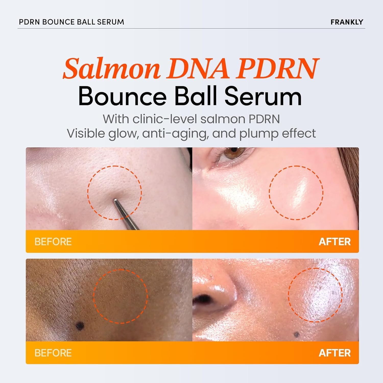 FRANKLY PDRN Bounce Ball Serum 30mL