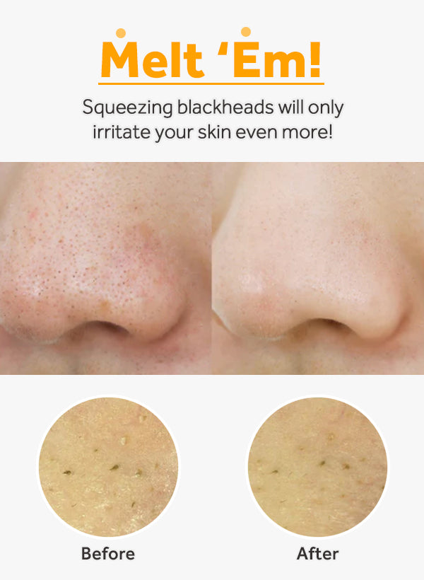 ma:nyo Pure Cleansing Oil 200ml