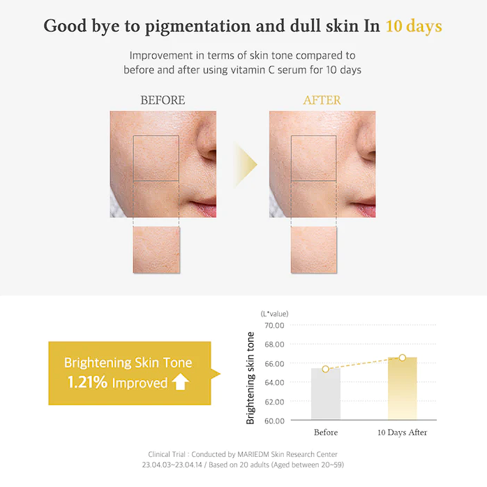 Skin tone brightness improved by 1.21% in 10 days.