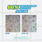 JUMISO Blackhead Melting Softener & Cotton Pad Set