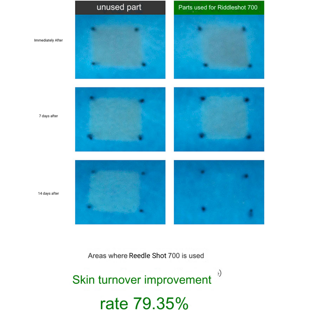 VT - Reedle Shot 700 30mL