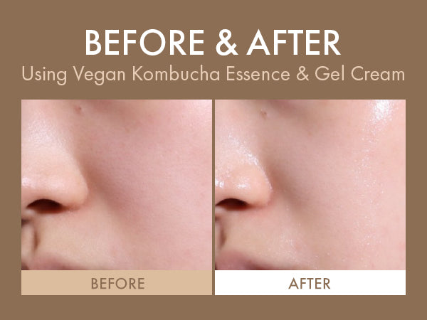 Dr. Ceuracle Vegan Kombucha Tea Essence 150mL