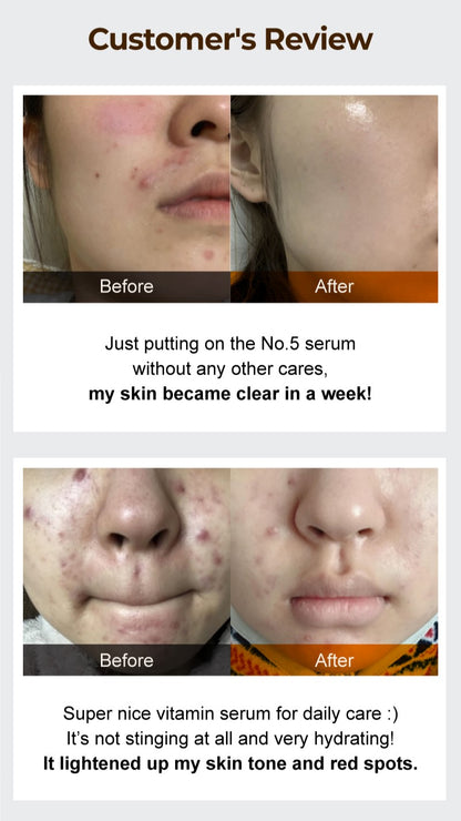 Numbuzin No.5 Goodbye Blemish Serum